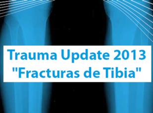 Gran convocatoria en trauma update 2013 “fracturas de tibia”
