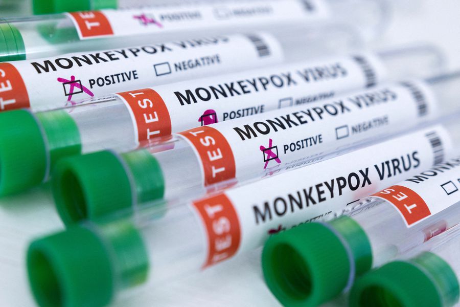 Lo que debes saber sobre la Viruela del Mono  Lo que debes saber sobre la Viruela del Mono