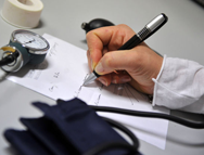 Lipoatrofia semicircular: las regulaciones a esta desconocida enfermedad laboral