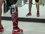 Osteointegración, un procedimiento único en chile y latinoamérica